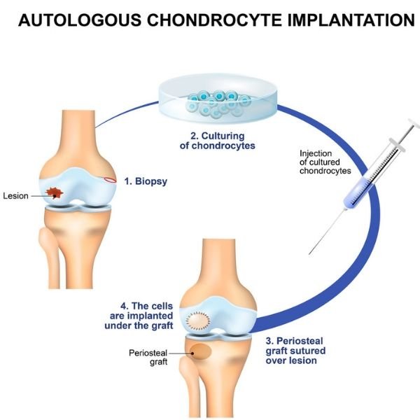 Chondrocytes microscopy