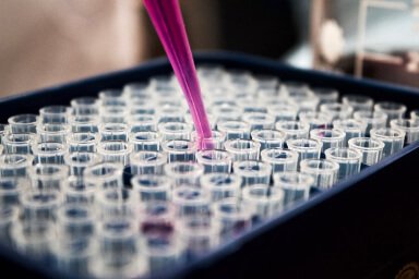 Microbiological Analysis