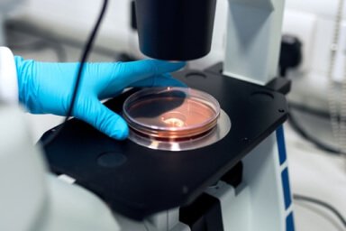 Flow Cytometry Assay
